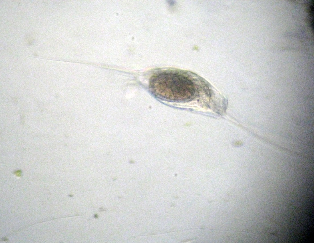 Filinia opoliensis...